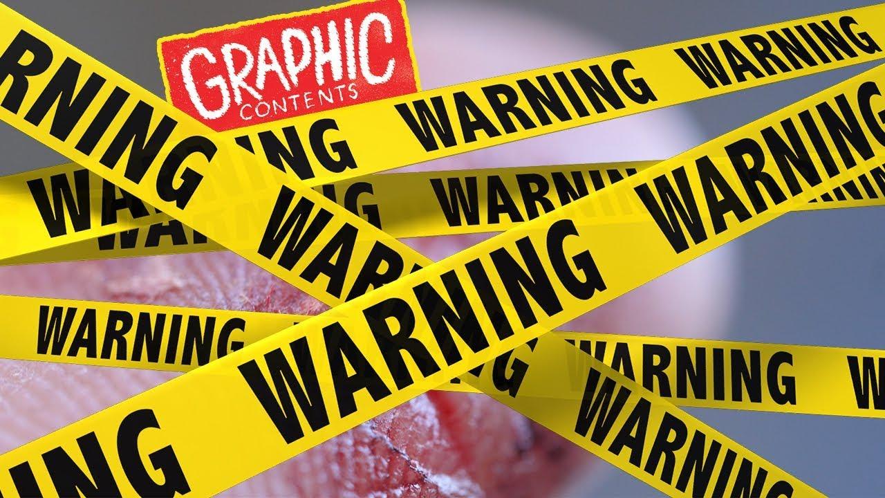 The Psychological Risks of Graphic Content on youtube